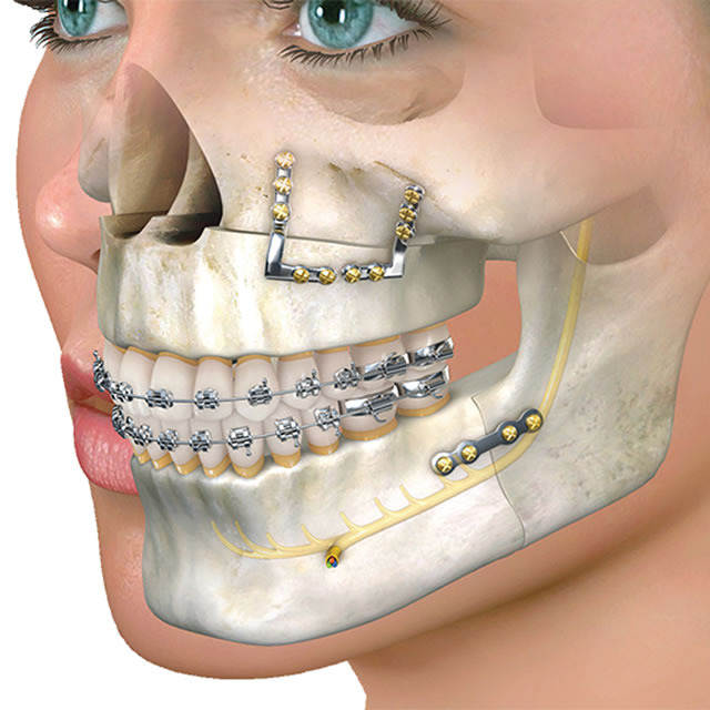 Imagem para curso de Residencia